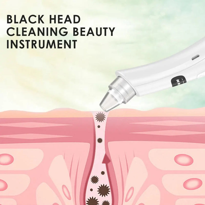 Limpador facial, 3 modos de limpeza, remove cravos e pele morta
